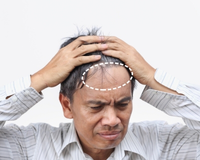 Mất bao lâu để tóc mọc lại?