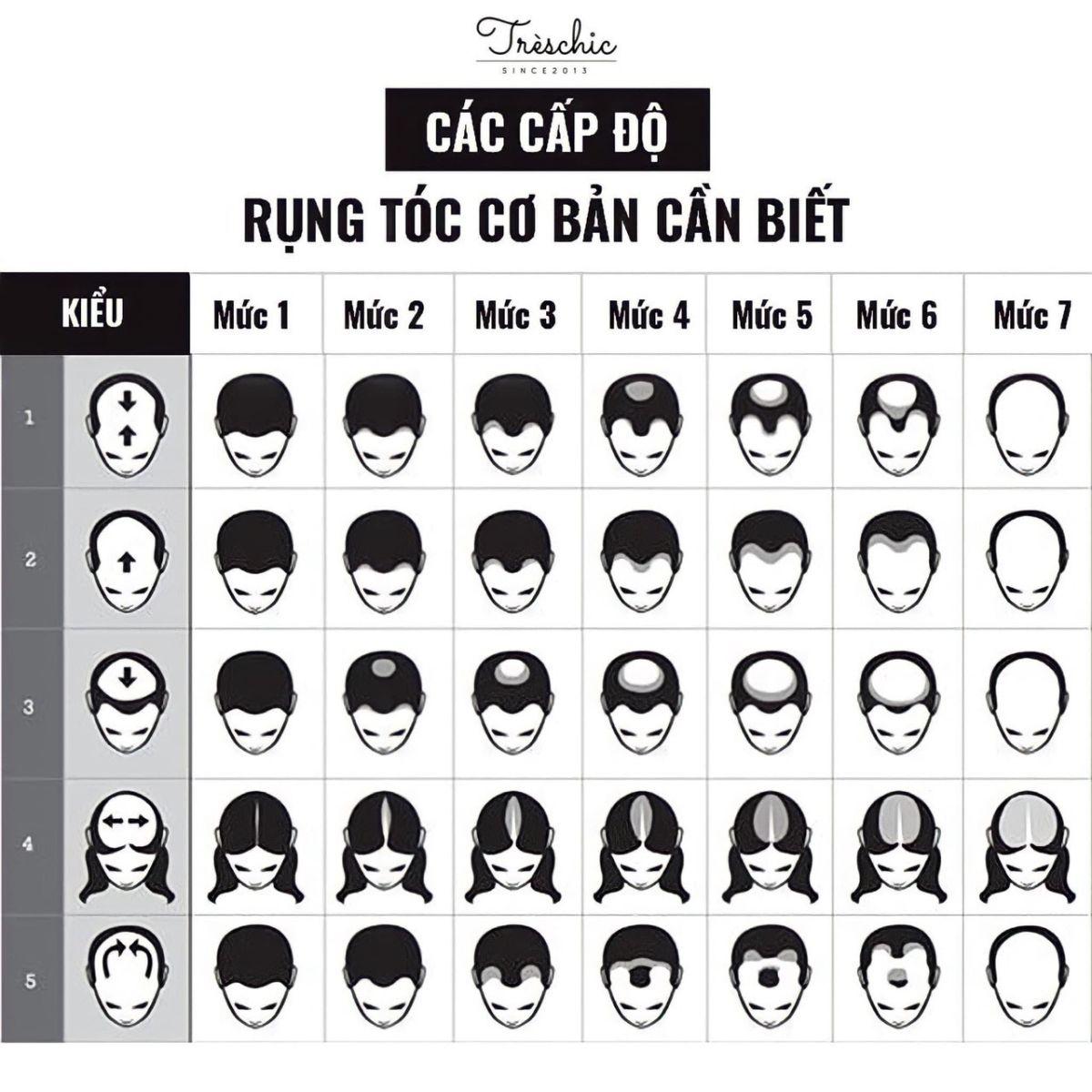 cach dieu tri rung toc dinh dau hieu qua 