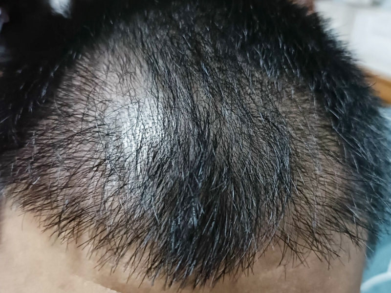 tu van cay toc mien phi nhiet tinh tan tam
