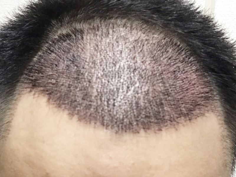 cay toc co dau khong