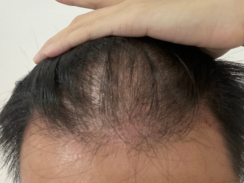 cac truong hop phu hop/ khong phu hop de cay toc