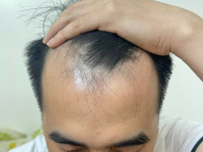 cac yeu to anh huong den chi phi cay toc vung tran