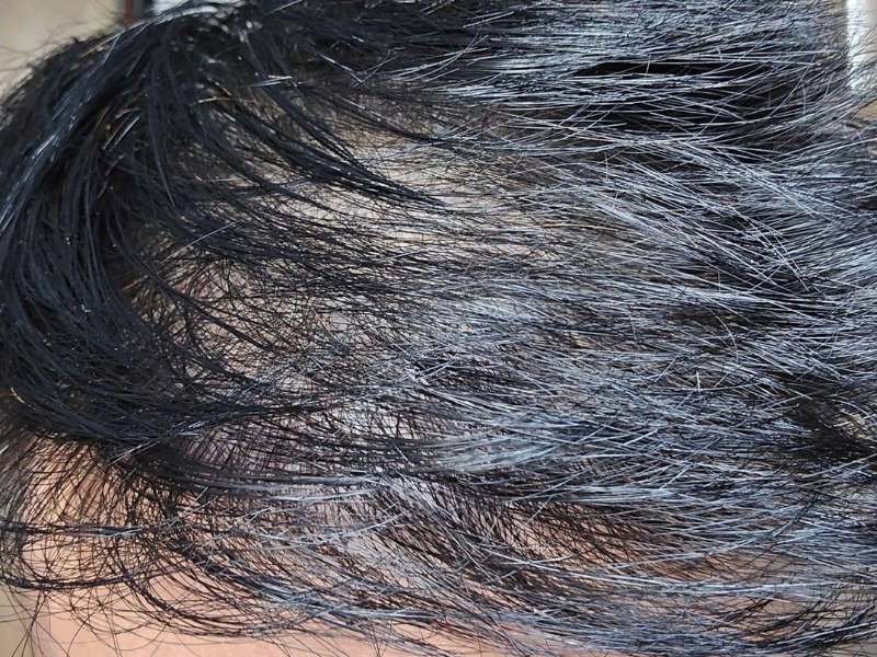 cac phuong phap cay toc pho bien cho hoi di truyen