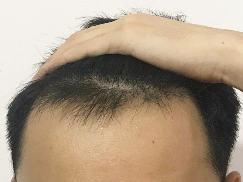 tai sao khong nen dung xit buoi khi rung toc