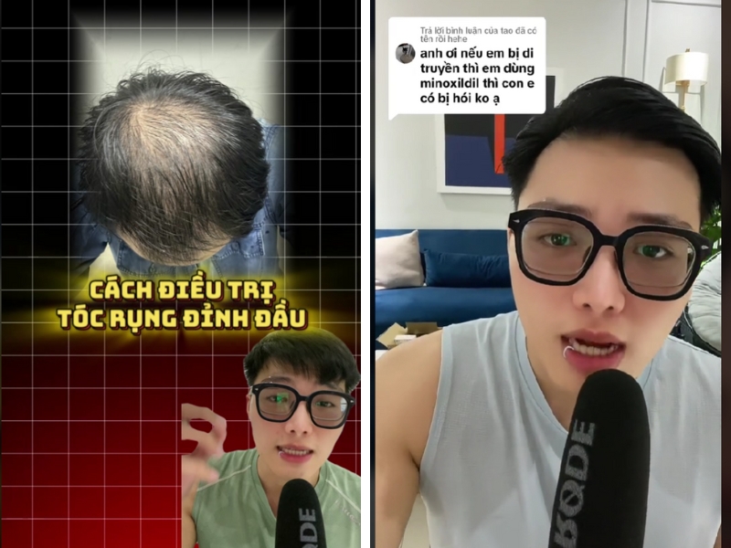tai sao nen lien he cho nghia cay toc de tu van tri rung toc hoi dau