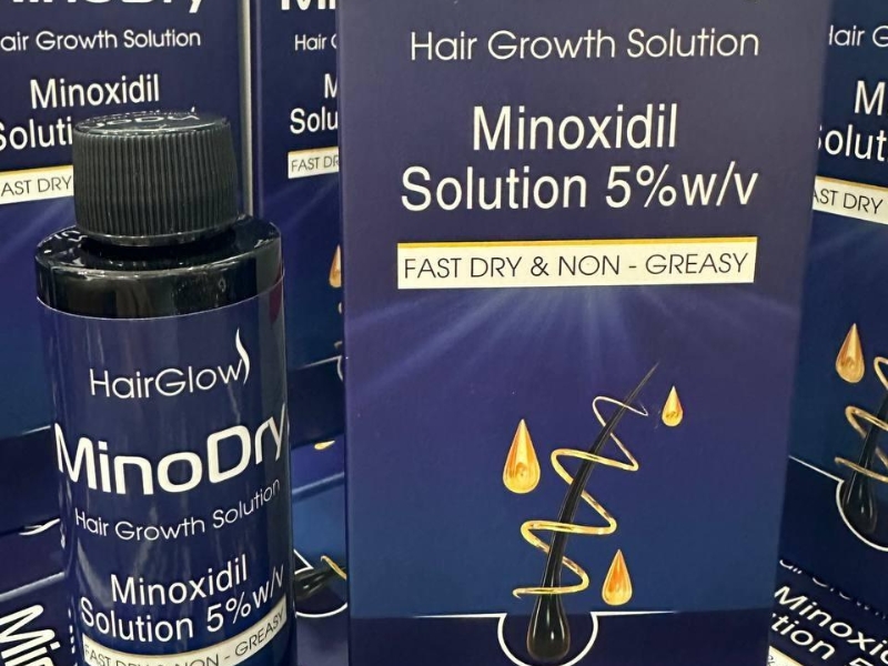 noi toi moc toc la phai dung minoxidil