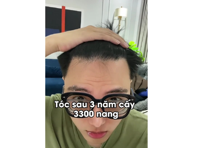 loi khuyen va kinh nghiem den tu nghia cay toc 