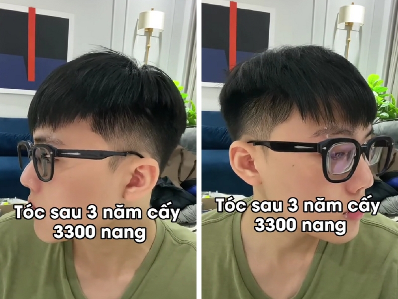 dia chi cung cap thong tin ve cay toc uy tin chat luong 