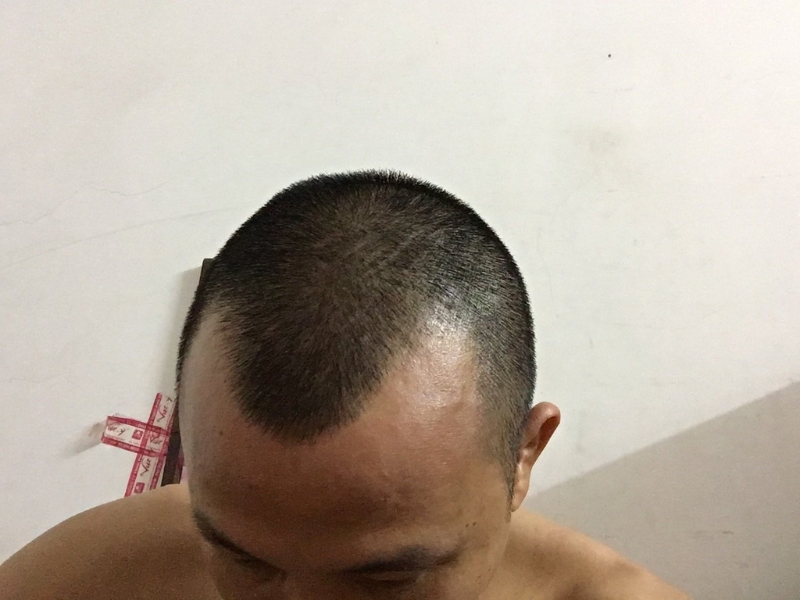 Nghia Cay Toc Cung cap giai phap cay toc an toan hieu qua