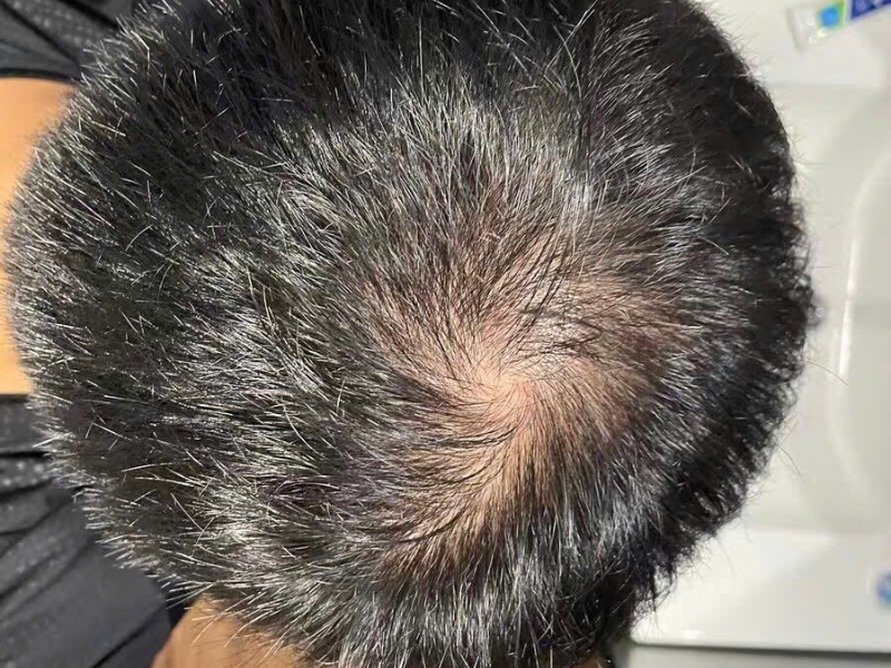 tu van phuc hoi ngan ngua rung toc mien phi